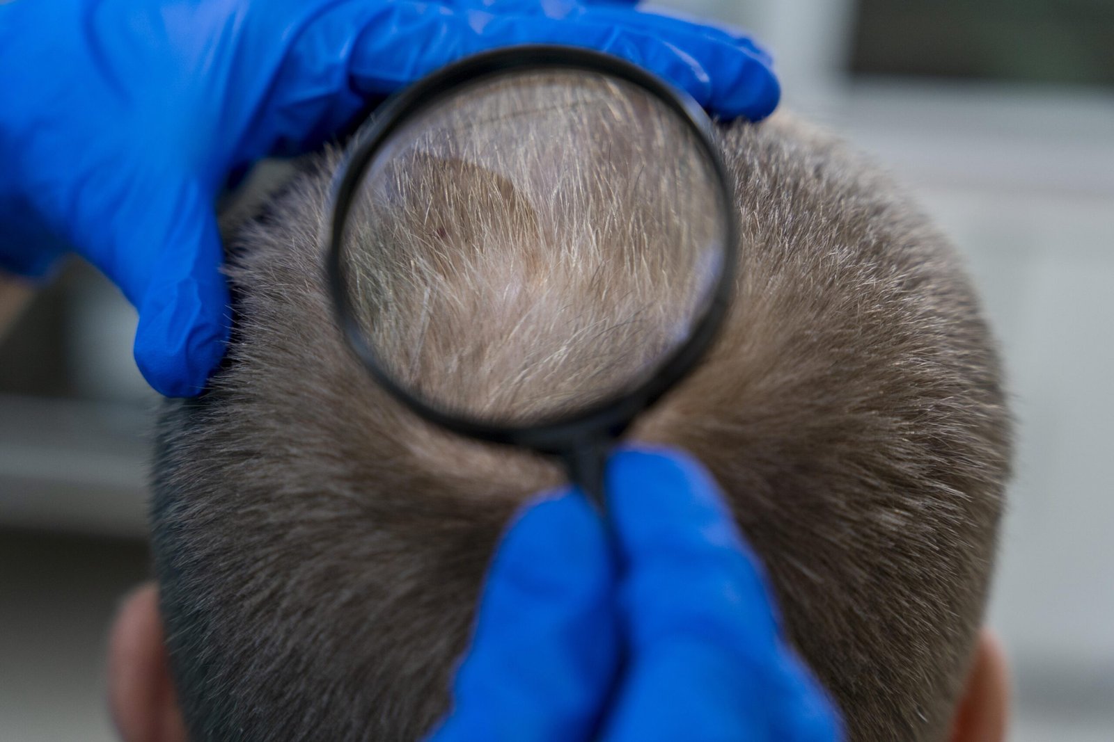adult-male-having-balding-problems (1)